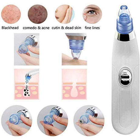 Pore Acne Pimple Removal and Vacuum Suction Facial Pore Cleaner